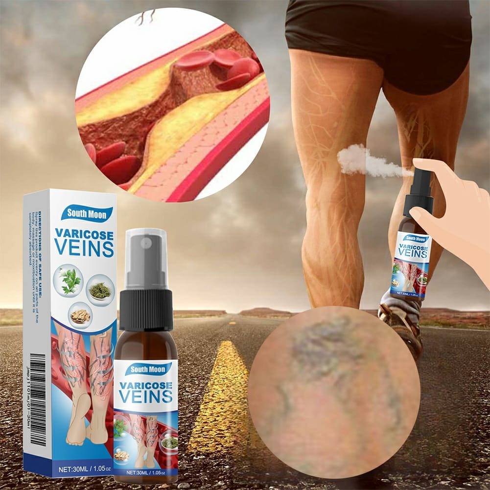 South Moon Varicose Veins Treatment Spray – 30ml